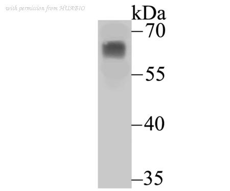 HUABIO ER1511-14 image 1