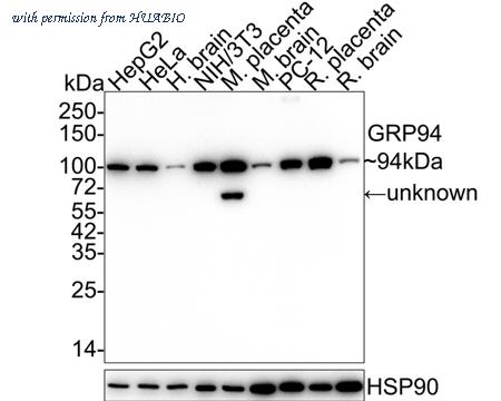 HUABIO ER1511-5 image 1