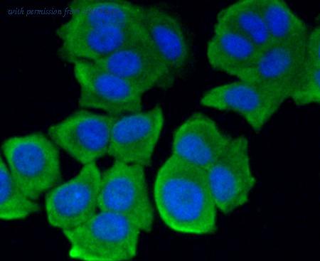 HUABIO ER1706-24 image 3