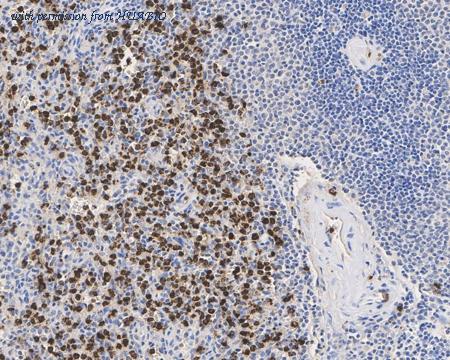 HUABIO ER1706-25 image 3