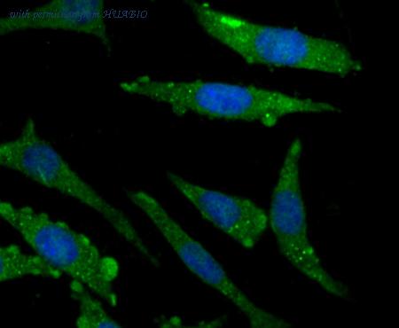 HUABIO ER1706-47 image 2