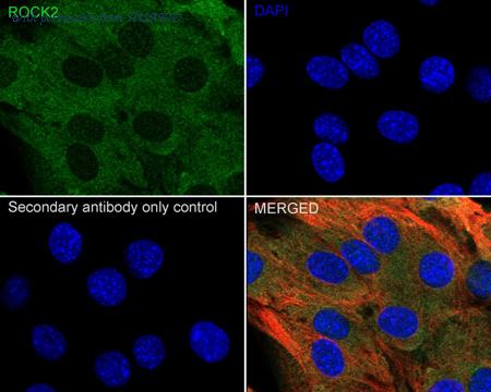 HUABIO ER1706-48 image 2