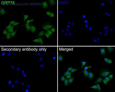 HUABIO ER1706-50 image 2