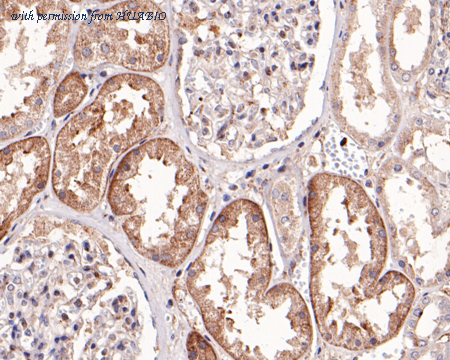 HUABIO ER1706-58 image 3