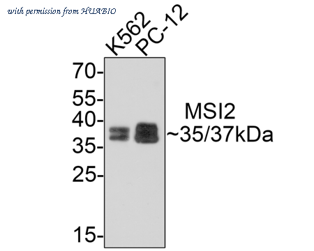 HUABIO ER1706-59 image 1