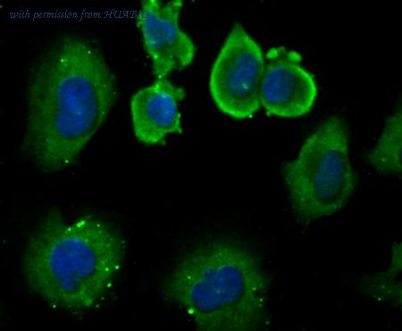 HUABIO ER1706-63 image 3