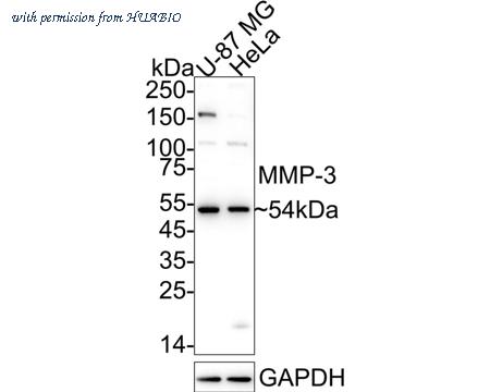 HUABIO ER1706-77 image 1