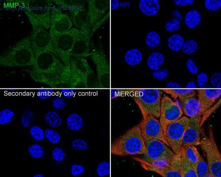 HUABIO ER1706-77 image 2