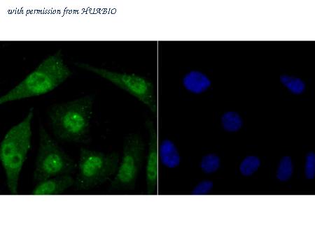 HUABIO ER1706-78 image 3