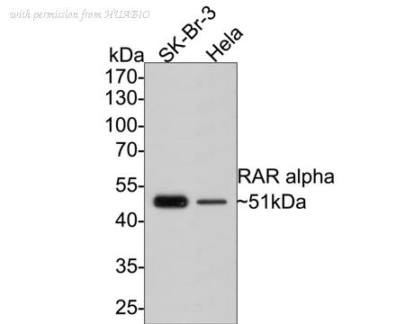 HUABIO ER1706-81 image 1