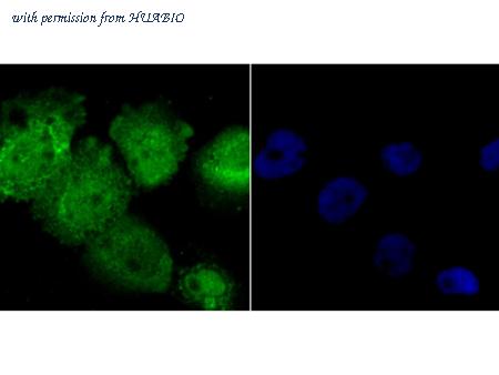 HUABIO ER1706-81 image 2