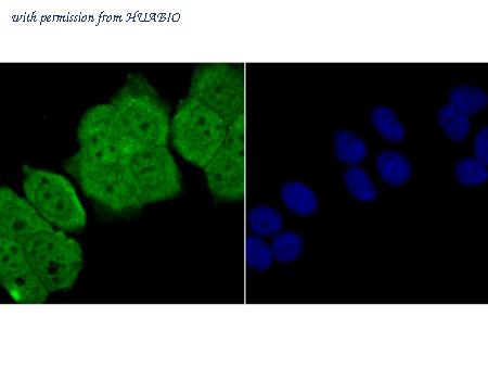 HUABIO ER1706-81 image 3