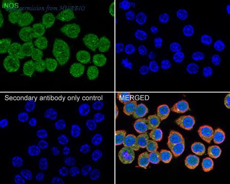 HUABIO ER1706-89 image 2