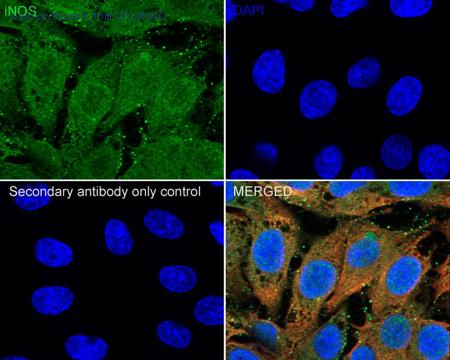 HUABIO ER1706-89 image 3