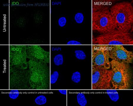 HUABIO ER1706-94 image 2