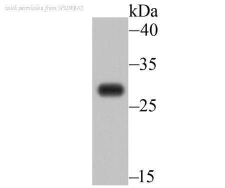 HUABIO ER1706-95 image 1