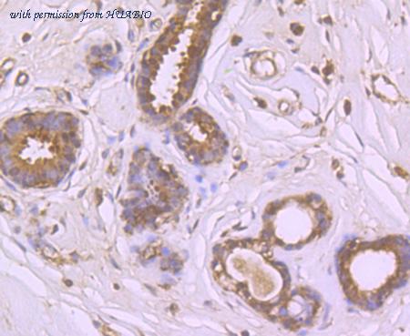 HUABIO ER1706-95 image 2