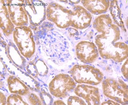 HUABIO ER1706-95 image 3