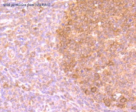 HUABIO ER1706-96 image 2