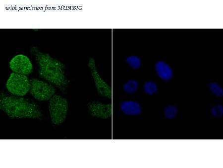 HUABIO ER1802-14 image 3