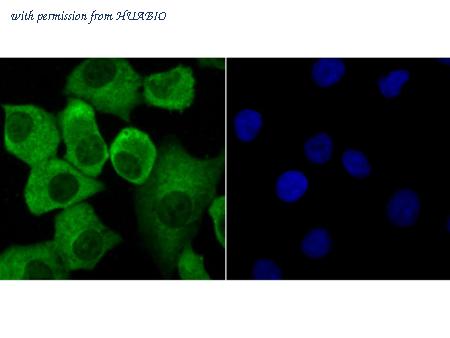 HUABIO ER1802-19 image 1