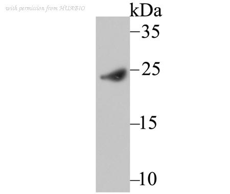 HUABIO ER1802-4 image 1
