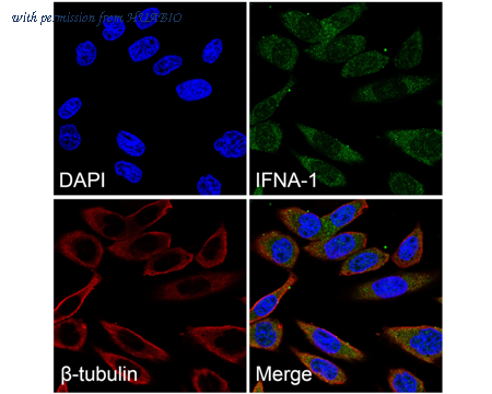 HUABIO ER1802-4 image 2