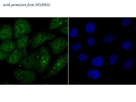 HUABIO ER1802-5 image 2