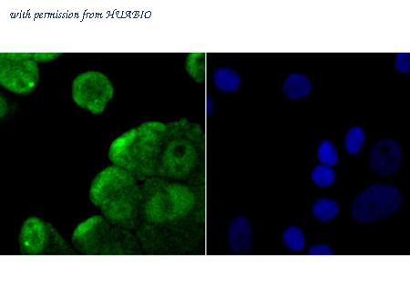 HUABIO ER1802-5 image 3