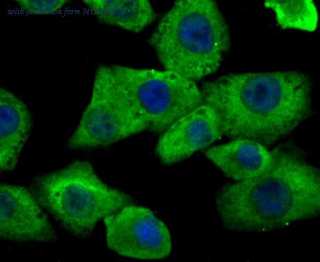 HUABIO ER1802-52 image 2