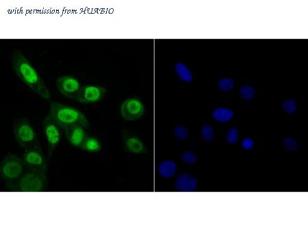 HUABIO ER1802-61 image 2