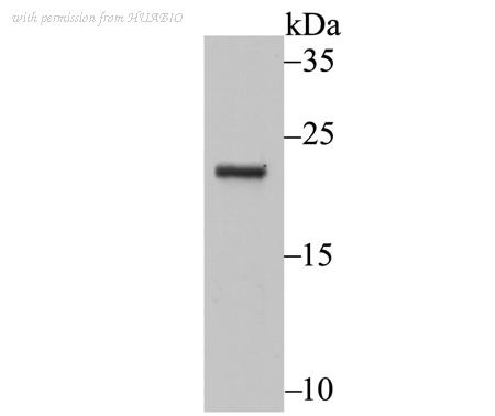 HUABIO ER1802-75 image 1