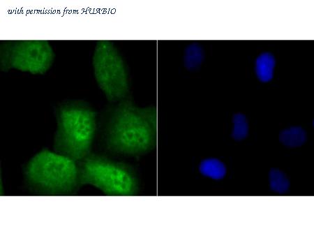 HUABIO ER1802-75 image 2