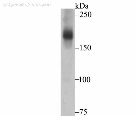 HUABIO ER1802-84 image 1