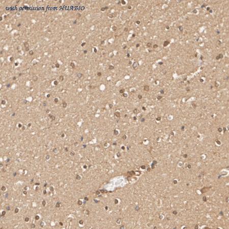 HUABIO ER1802-89 image 1