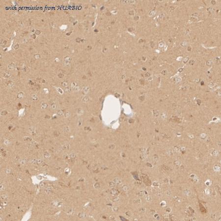 HUABIO ER1802-89 image 3