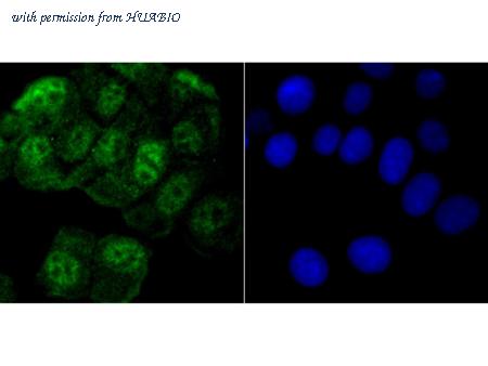 HUABIO ER1802-9 image 2