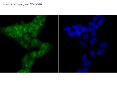 HUABIO ER1802-9 image 3