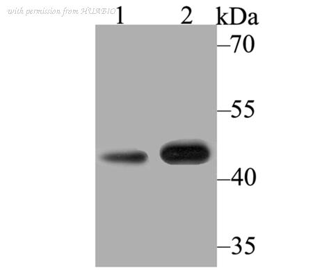 HUABIO ER1803-03 image 1
