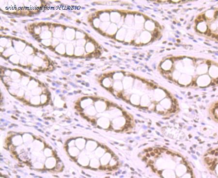 HUABIO ER1803-04 image 2