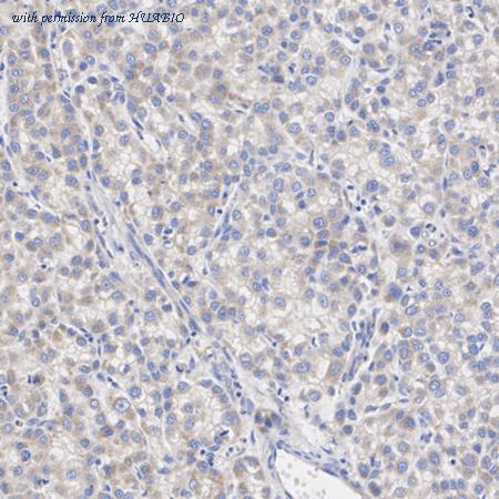 HUABIO ER1803-05 image 2