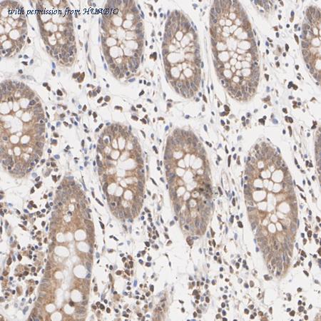 HUABIO ER1803-05 image 3