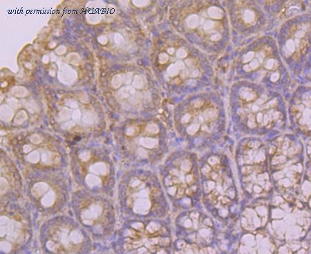 HUABIO ER1803-07 image 2