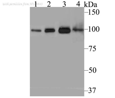 HUABIO ER1803-09 image 2