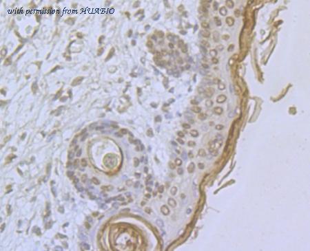 HUABIO ER1803-11 image 2