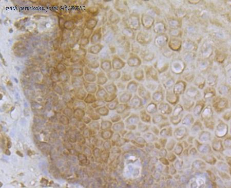 HUABIO ER1803-11 image 3