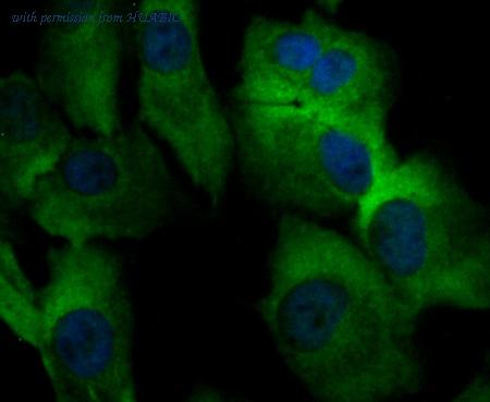 HUABIO ER1803-12 image 3