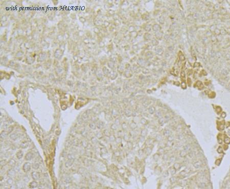 HUABIO ER1803-14 image 3