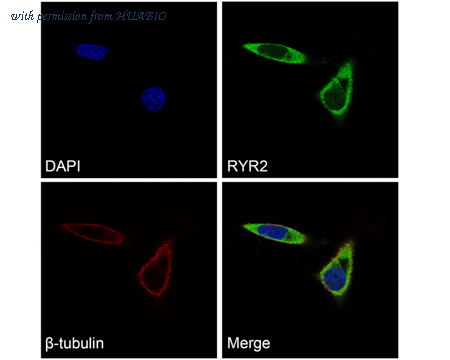 HUABIO ER1803-22 image 2
