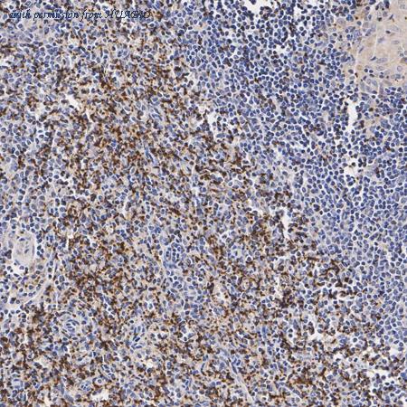 HUABIO ER1803-26 image 2